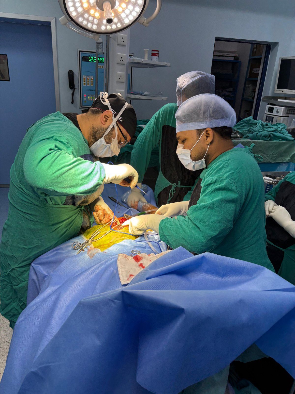 Joint replacement surgery in progress in theatre