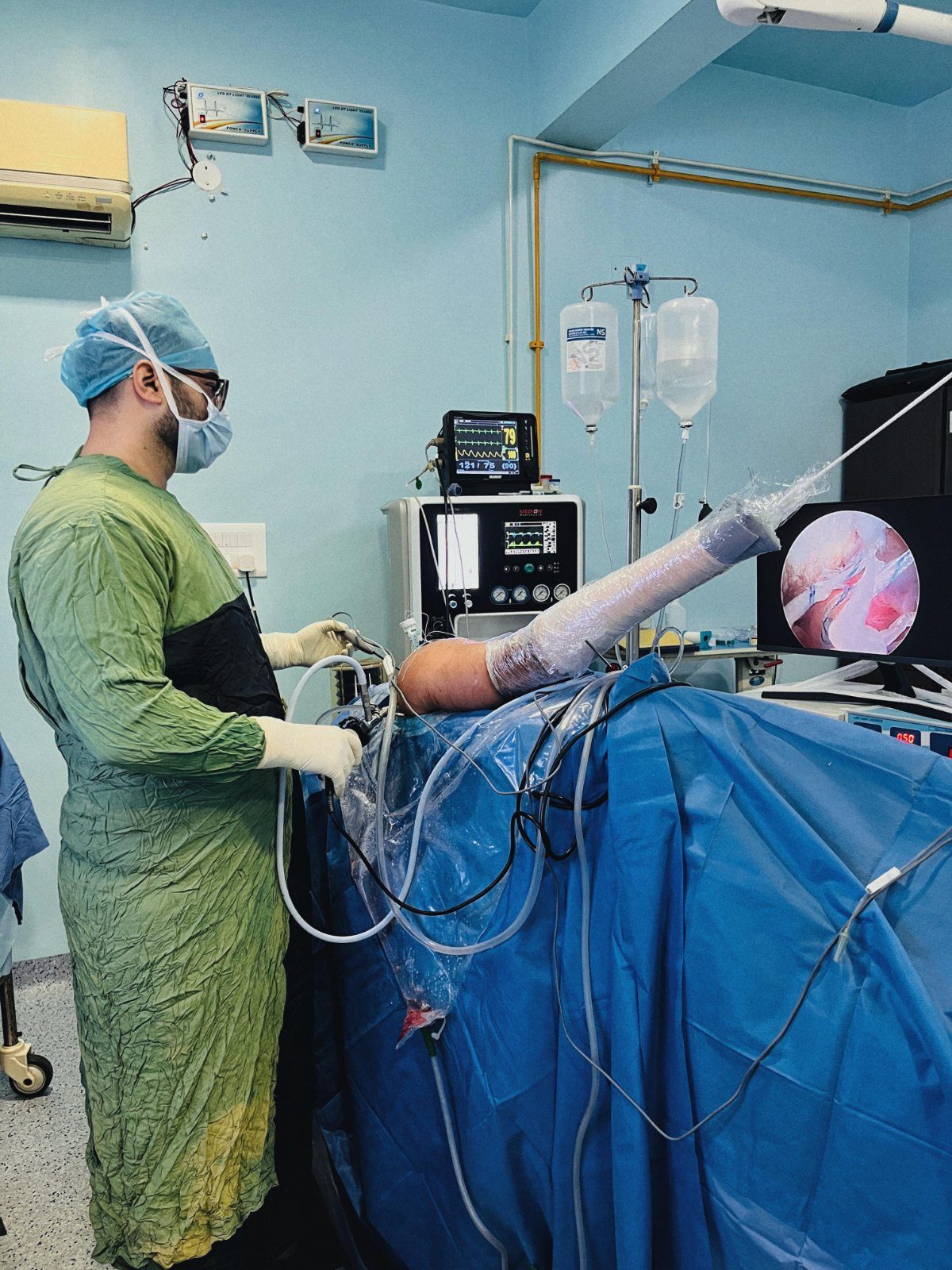 Shoulder arthroscopy in progress, arm in traction